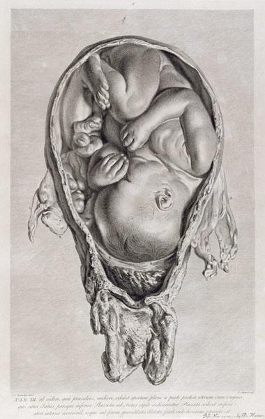 Anatomical drawing of a foetus in the womb