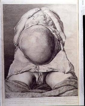 Anatomical drawing of the abdomen of a pregnant female human with skin peeled back