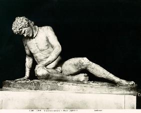 Dying Gaul